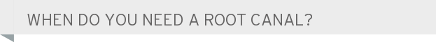 When do you need a root canal?